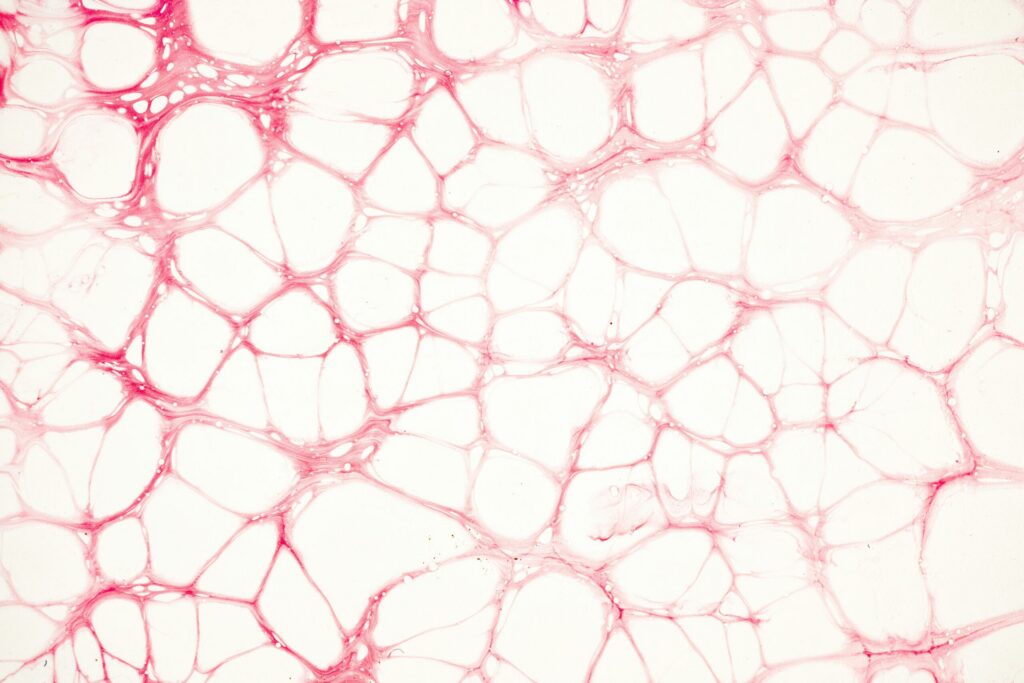 PROFESSOR WONG WING TAK AND TEAM UNVEIL GROUNDBREAKING RESEARCH ON TYPE 2 CYTOKINES AND ANGIOGENESIS IN ISCHEMIC MUSCLE
